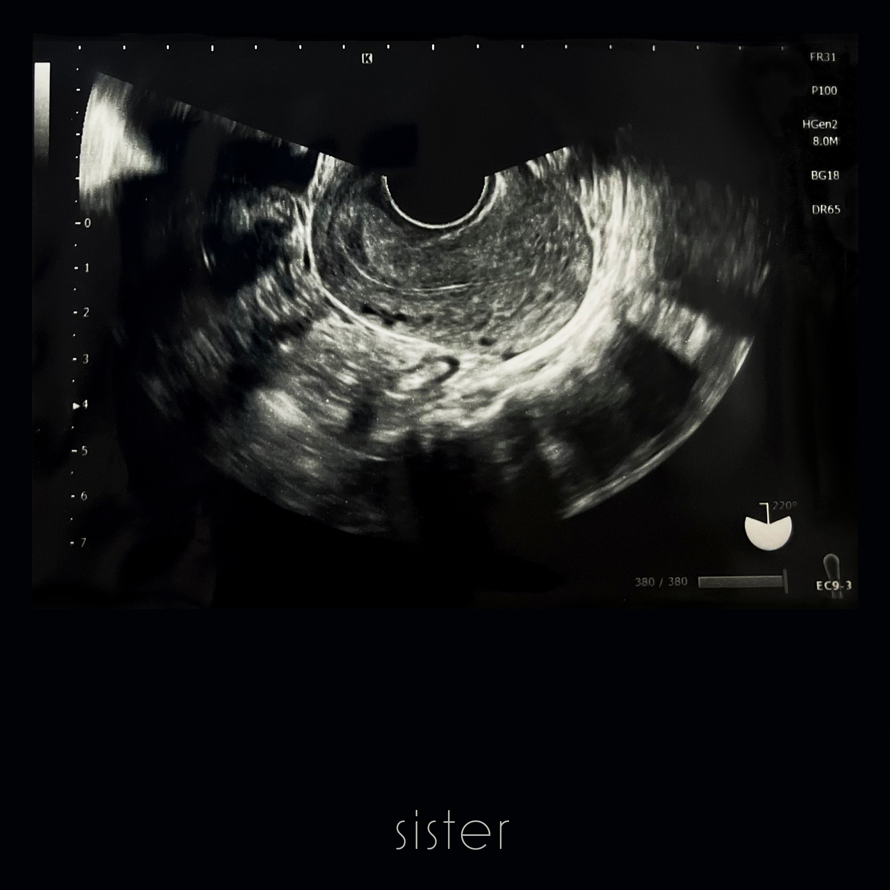 sister 歌詞 チョーキューメイ ドラマ「ビジネス婚―好きになっ